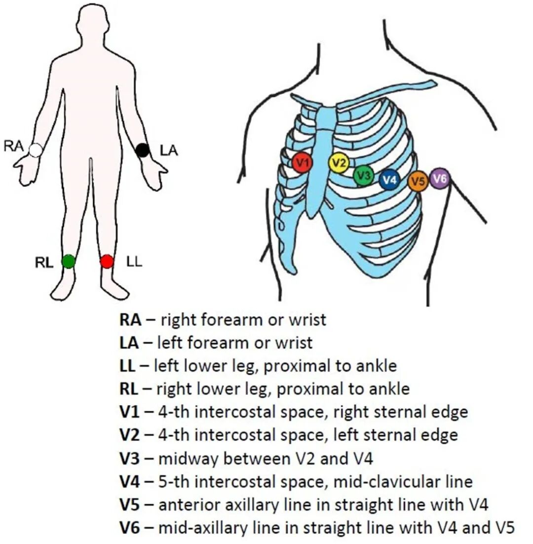 心电图12导怎么组成儿童心电图操作（常规12导联）_https://www.jmylbn.com_新闻资讯_第7张