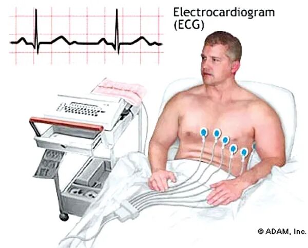 心电图12导怎么组成儿童心电图操作（常规12导联）_https://www.jmylbn.com_新闻资讯_第3张
