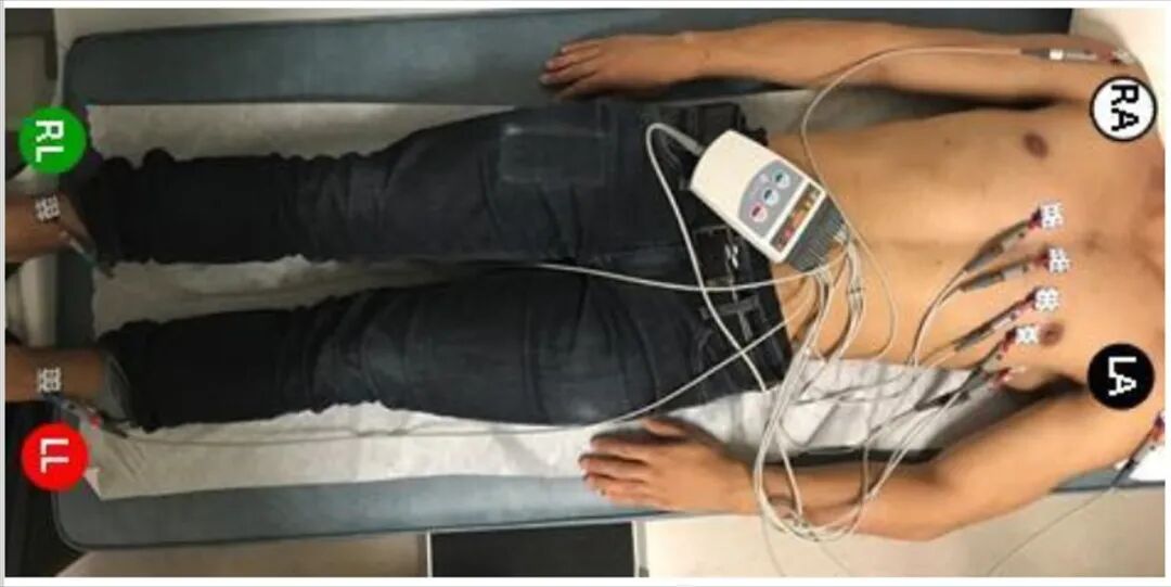 心电图12导怎么组成儿童心电图操作（常规12导联）_https://www.jmylbn.com_新闻资讯_第12张