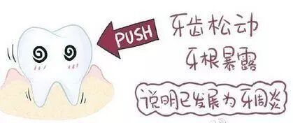 牙周炎影响的不仅仅是牙齿！更是全身健康！