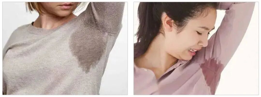 狐臭的人自己闻得到吗？药企专家建议注意这两点，从此告别狐臭烦恼