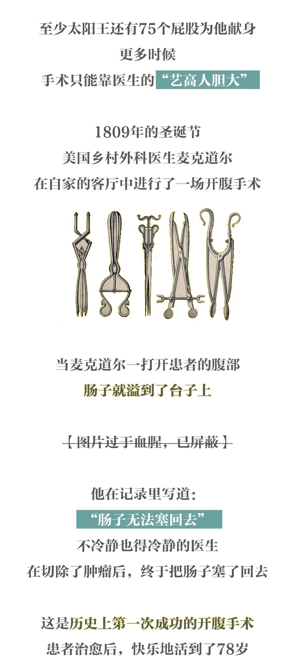 弯血管钳怎么读柳叶刀的历史！_https://www.jmylbn.com_新闻资讯_第4张