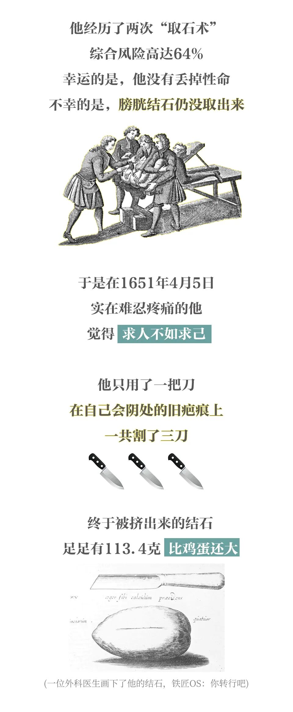 弯血管钳怎么读柳叶刀的历史！_https://www.jmylbn.com_新闻资讯_第2张