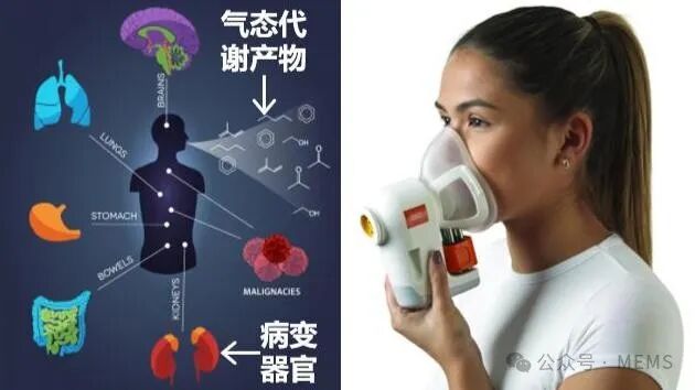 无创仪器是什么呼气式肿瘤无创早筛技术与仪器：吹口气有望检测多种癌症_https://www.jmylbn.com_新闻资讯_第2张