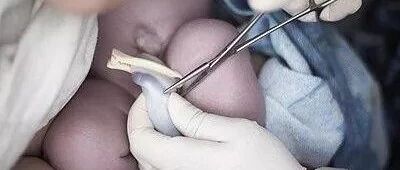 胎盘/脐带间充质干细胞移植缘何无需配型