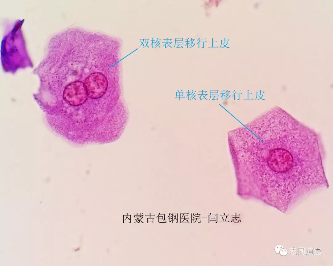 表层移行上皮细胞 志同道盒 微信公众号文章阅读 Wemp
