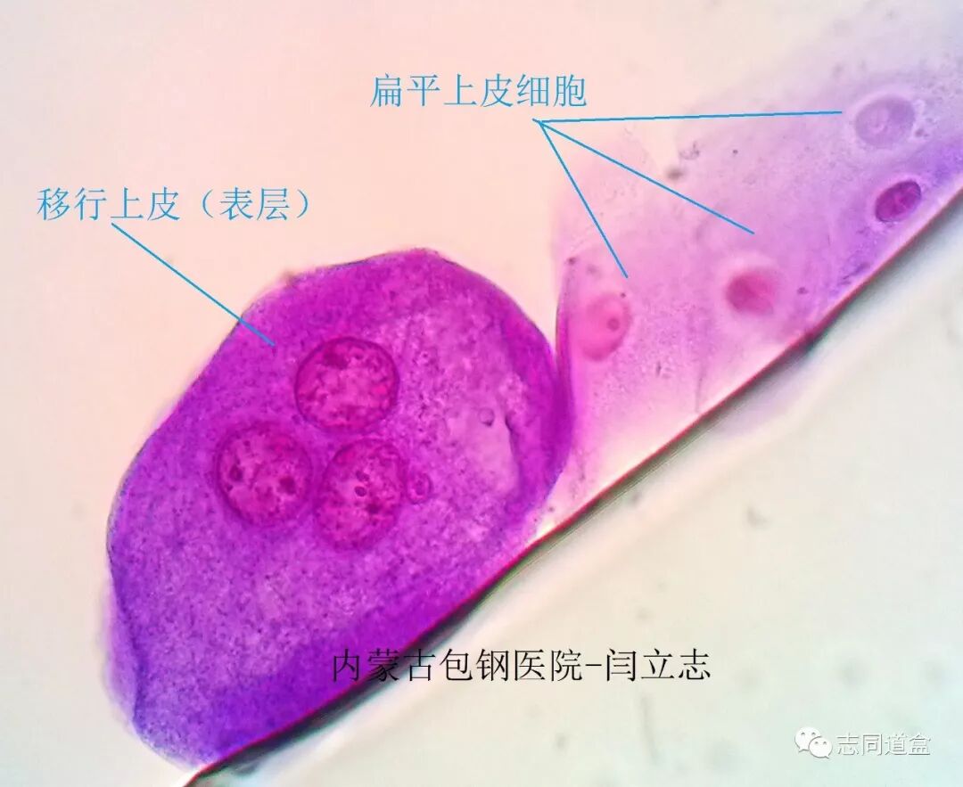 表层移行上皮细胞 志同道盒 微信公众号文章阅读 Wemp