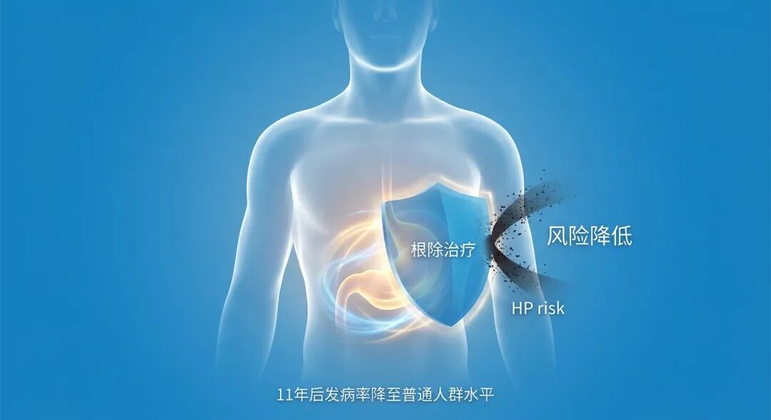 一张温暖且专业的医学插画：一个抽象的发光人体轮廓，胃部受到蓝色“根除治疗”能量盾牌的保护，将外界风险挡在外面。画面配有中文标签“风险降低”及数据说明“11年后发病率降至普通人群水平”，传递出医学干预带来的安全感与希望。