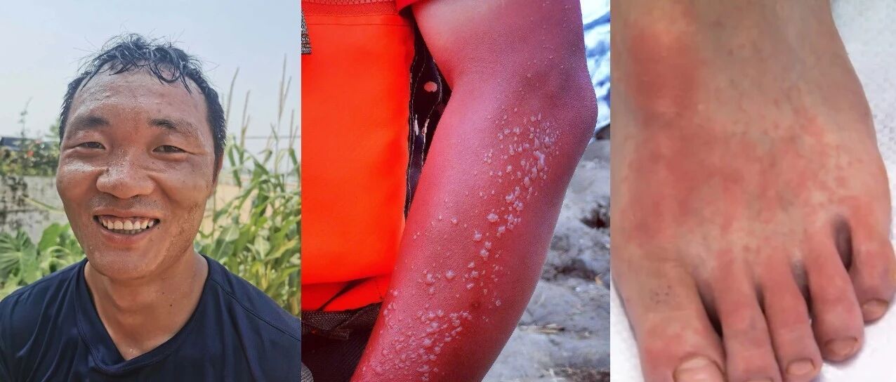 这样的脸、手、脚……都是你们最帅的样子