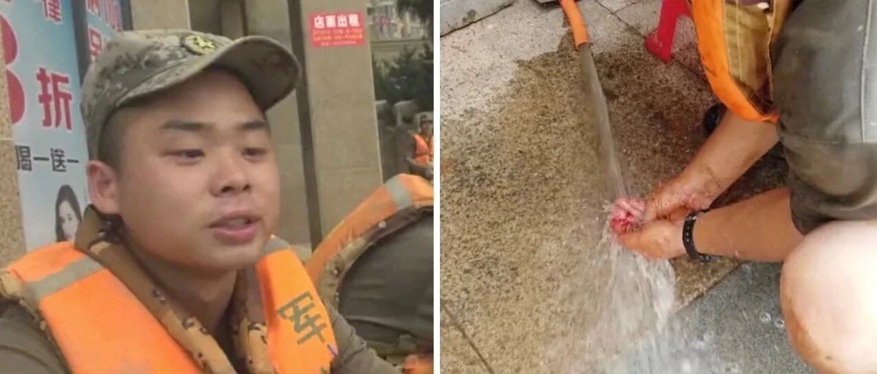 你说不疼，但是我们心疼……