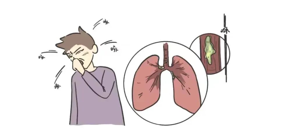 为什么用震动排痰【呼吸康复】多频振动排痰机----帮助排痰，让肺舒坦！_https://www.jmylbn.com_新闻资讯_第5张