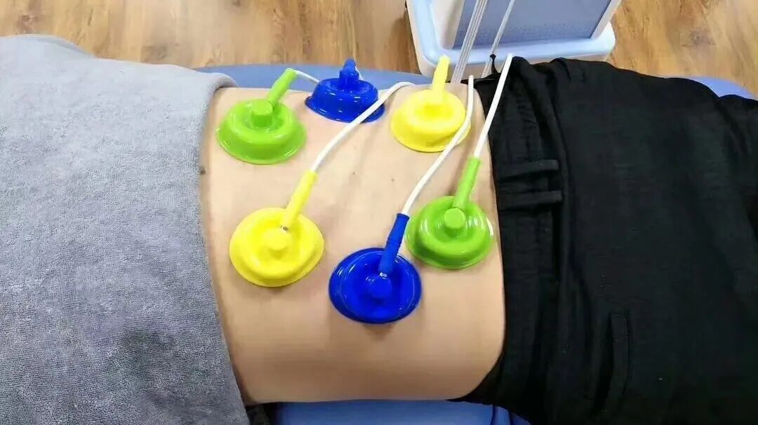 什么是中频干扰【物理治疗】中频治疗 “神器＂ ——干扰电_https://www.jmylbn.com_新闻资讯_第19张