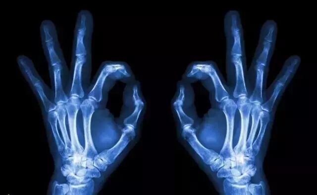 DR影像怎么重新上传【医疗服务提升】MR、CT、DR全新升级，精准影像助力精准诊疗！_https://www.jmylbn.com_新闻资讯_第7张