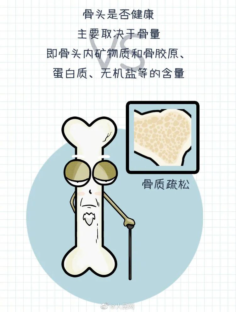 你真正了解骨质疏松吗？