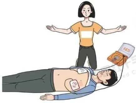 aed电极贴怎么贴应急科普——“救命神器”AED_https://www.jmylbn.com_新闻资讯_第8张