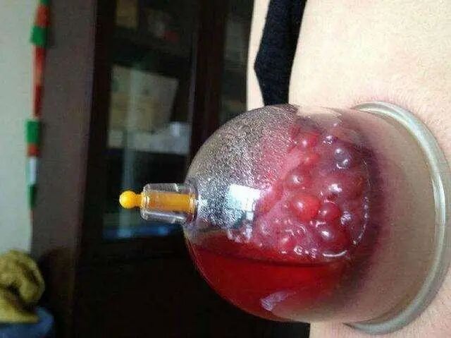 提醒！罐，不能乱拔