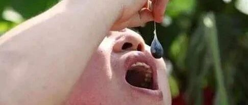 寄生虫病或许不再是“穷人病”，而是“无知病”...