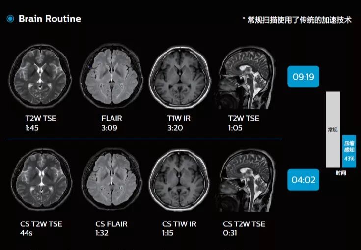 用于高分辨率全脑三维t1, t2, tof, flair, dwi, swi, nerveview,