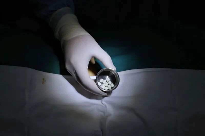 北京首例“戒酒芯片”手术完成：一次效力超150天，让喝酒变得“不那么快乐”(图2)