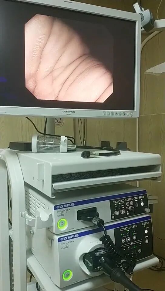 奥林巴斯内窥镜怎么样大牌来了！上海医博肛泰医院引进奥林巴斯CV290电子胃肠镜，超高清，新“镜”界！_https://www.jmylbn.com_新闻资讯_第2张