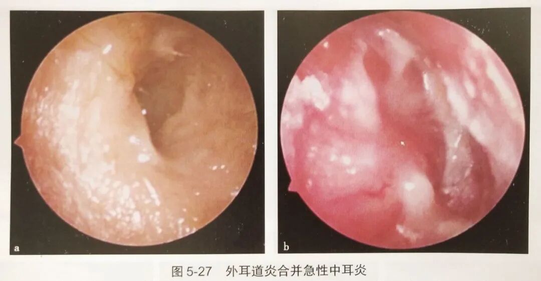 耳朵内窥镜什么样小小耳内镜  内有大乾坤_https://www.jmylbn.com_新闻资讯_第8张
