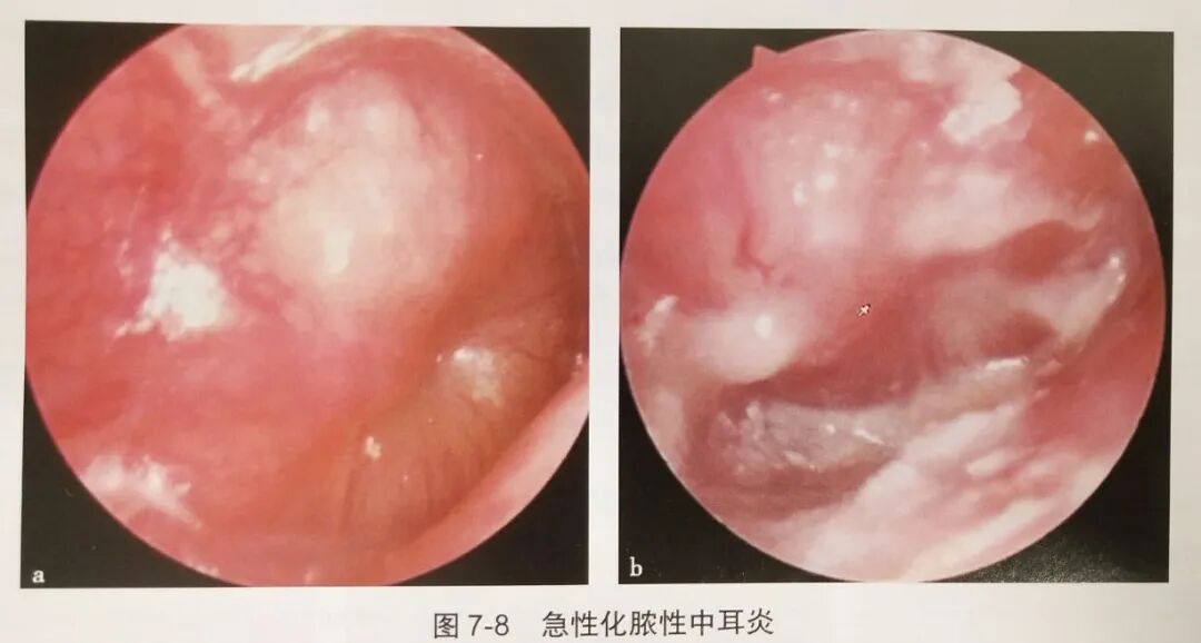 耳朵内窥镜什么样小小耳内镜  内有大乾坤_https://www.jmylbn.com_新闻资讯_第9张
