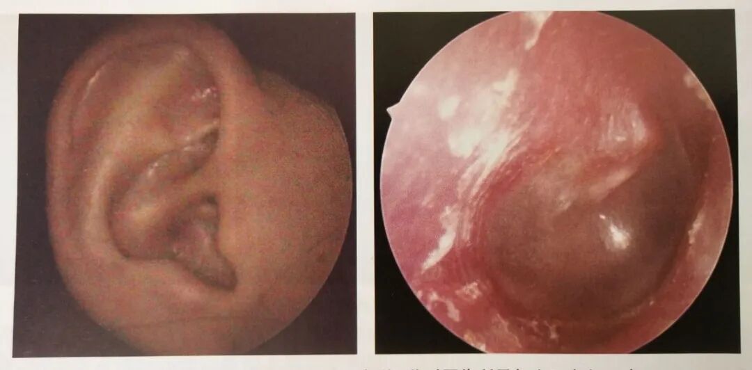 耳朵内窥镜什么样小小耳内镜  内有大乾坤_https://www.jmylbn.com_新闻资讯_第6张