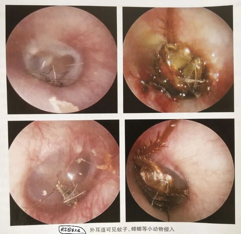 耳朵内窥镜什么样小小耳内镜  内有大乾坤_https://www.jmylbn.com_新闻资讯_第7张
