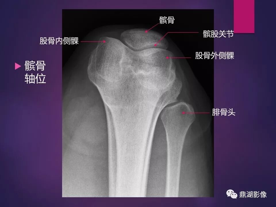 全身骨肌系统正常影像解剖（高清图谱）