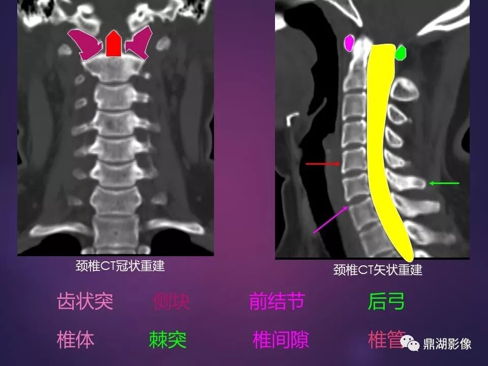 全身骨肌系统正常影像解剖（高清图谱）