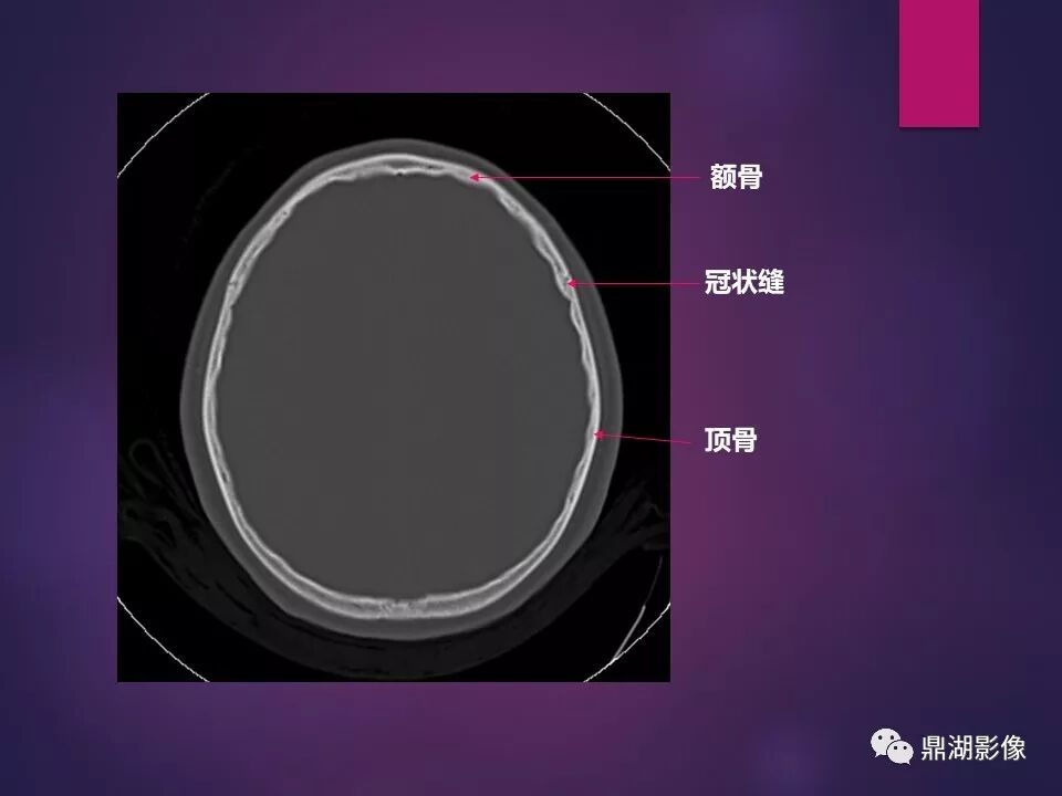 全身骨肌系统正常影像解剖（高清图谱）