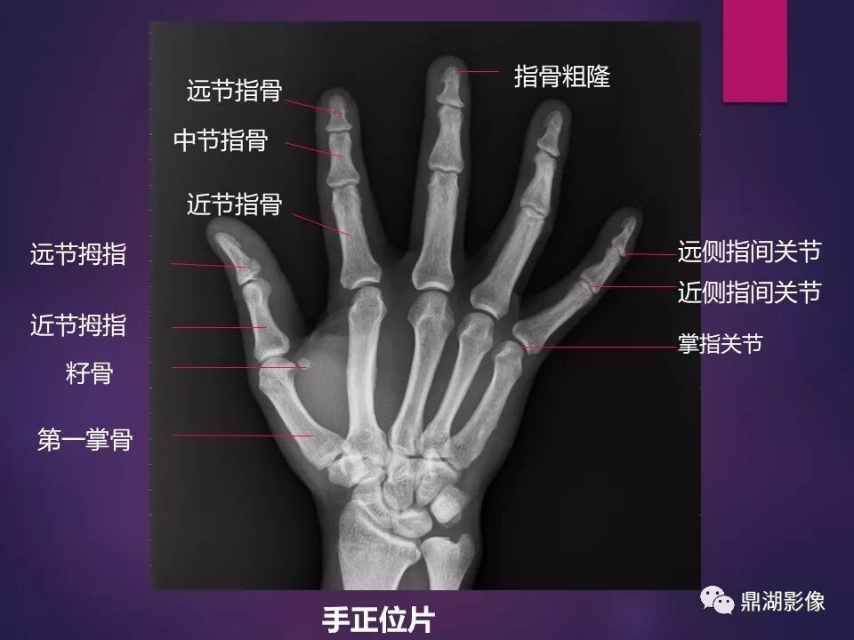 全身骨肌系统正常影像解剖（高清图谱）
