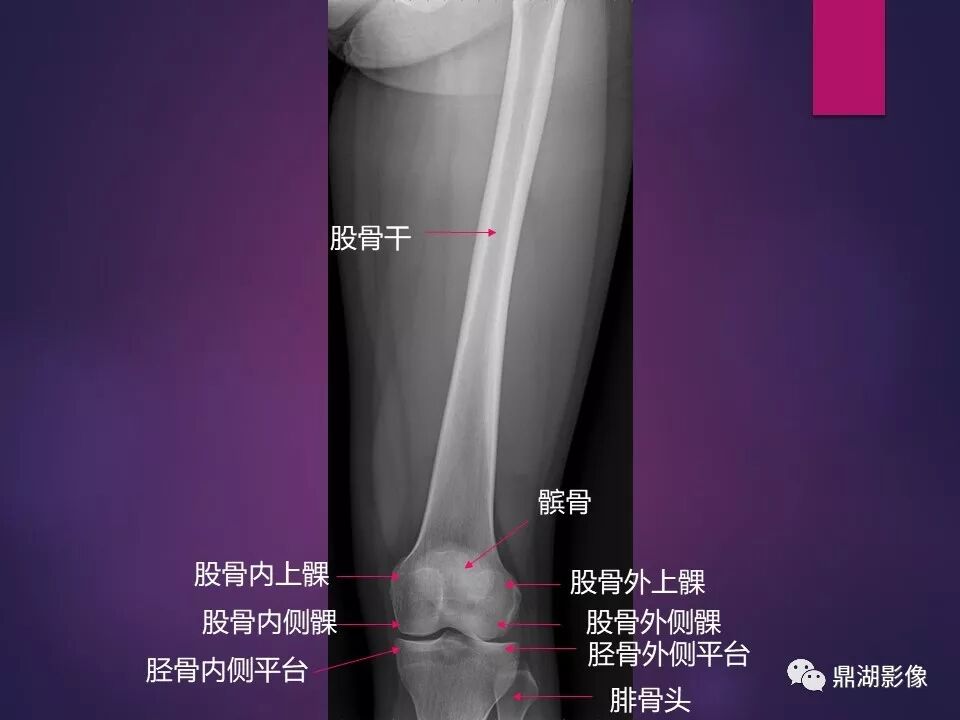 全身骨肌系统正常影像解剖（高清图谱）