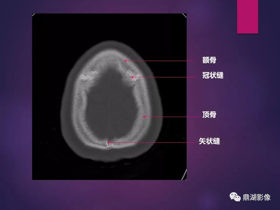 全身骨肌系统正常影像解剖（高清图谱）
