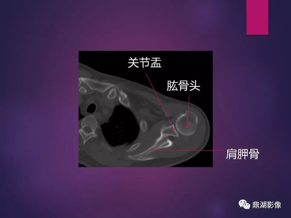 全身骨肌系统正常影像解剖（高清图谱）