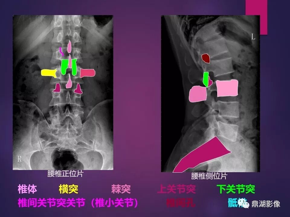 全身骨肌系统正常影像解剖（高清图谱）