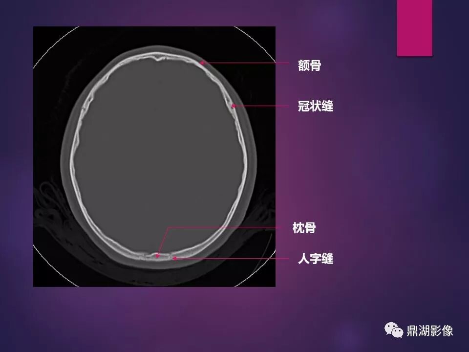 全身骨肌系统正常影像解剖（高清图谱）
