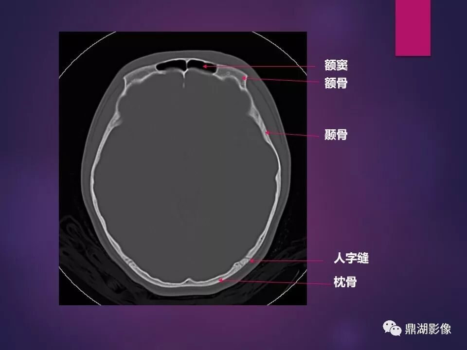 全身骨肌系统正常影像解剖（高清图谱）