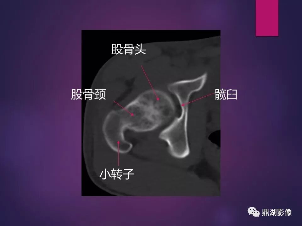 全身骨肌系统正常影像解剖（高清图谱）