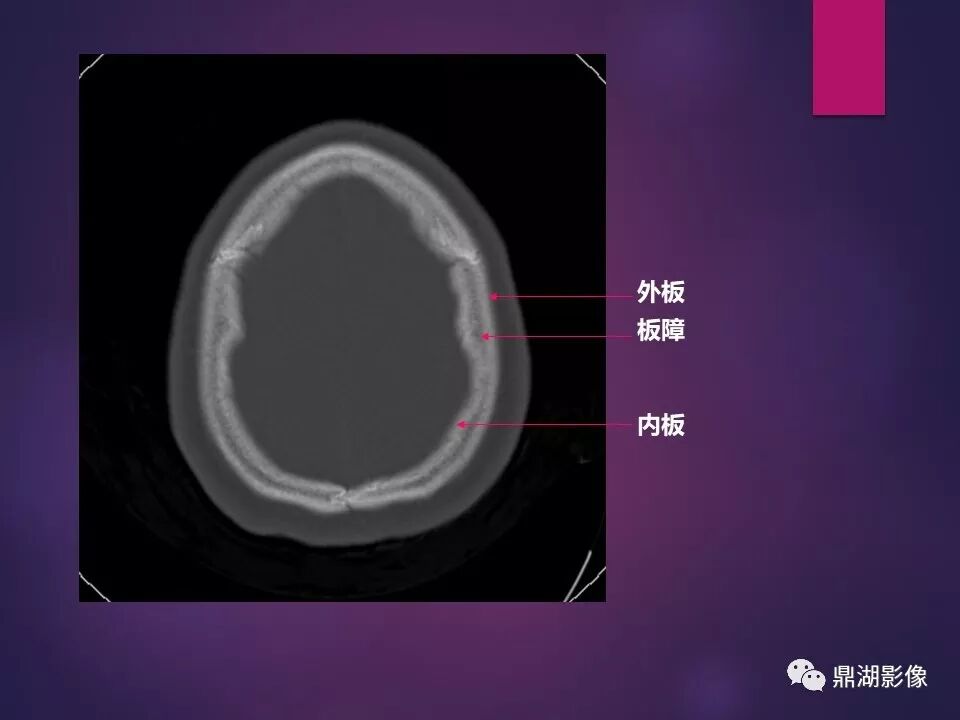 全身骨肌系统正常影像解剖（高清图谱）