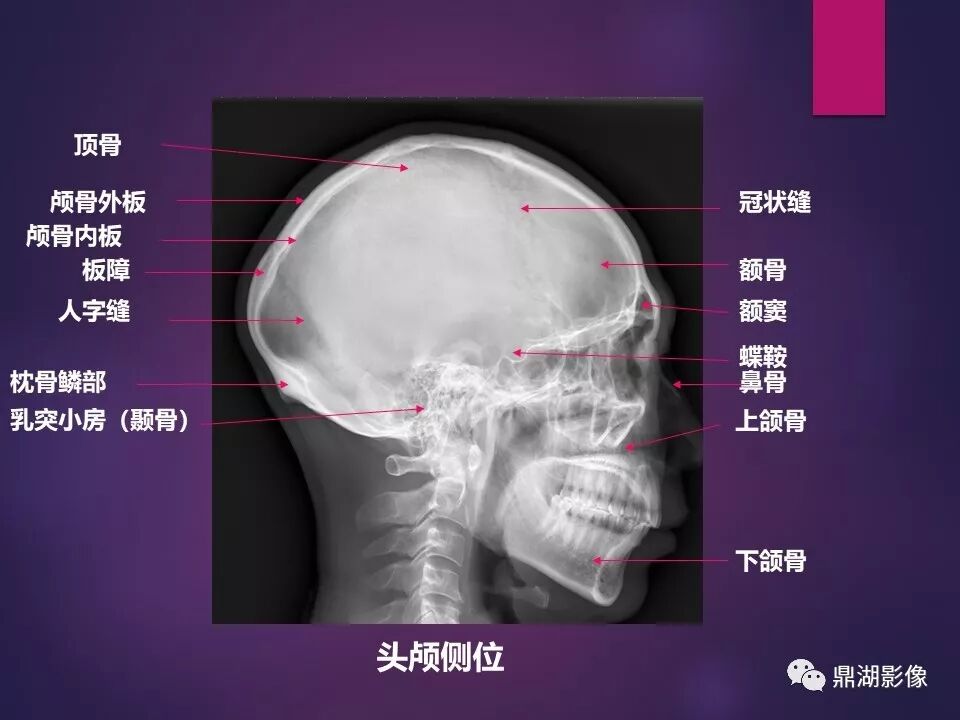 全身骨肌系统正常影像解剖（高清图谱）