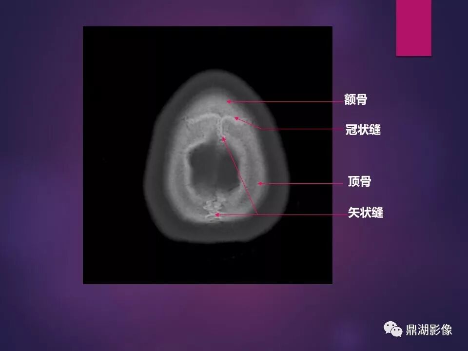 全身骨肌系统正常影像解剖（高清图谱）