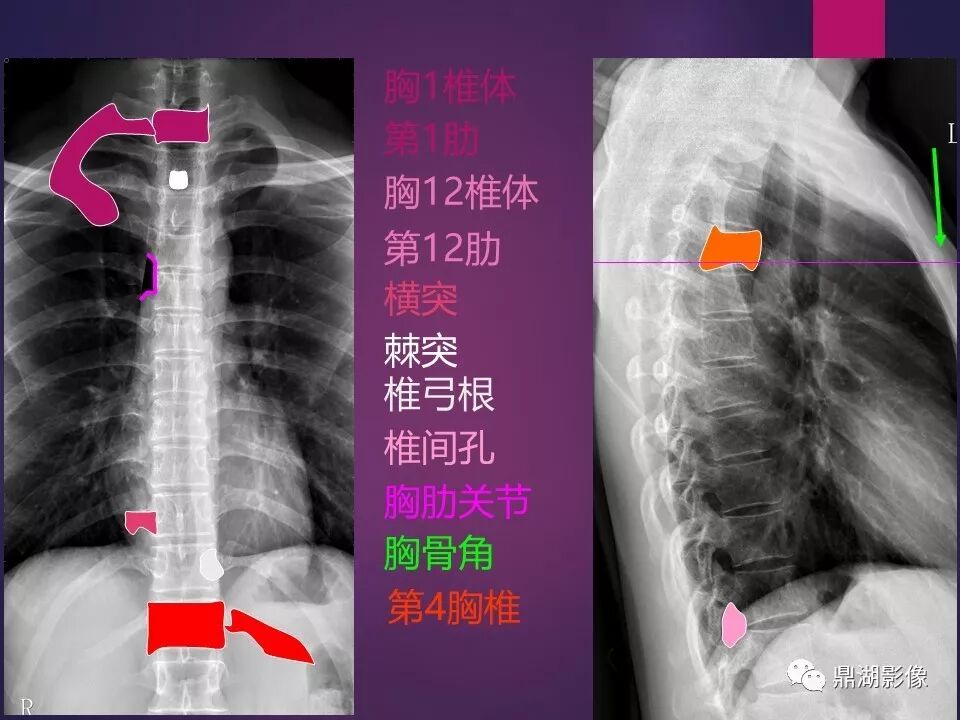 全身骨肌系统正常影像解剖（高清图谱）