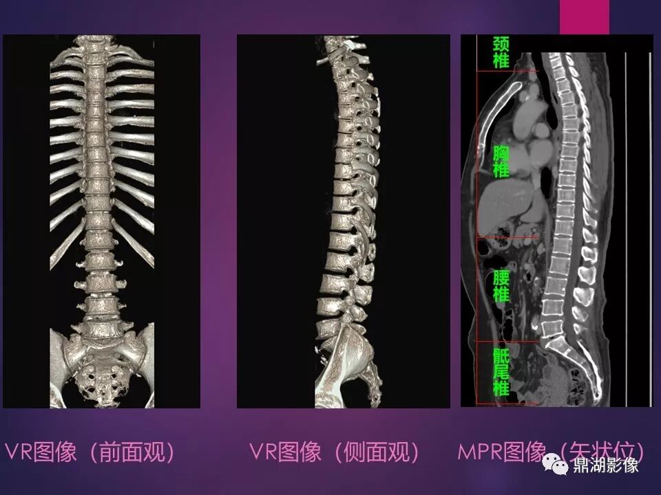 全身骨肌系统正常影像解剖（高清图谱）