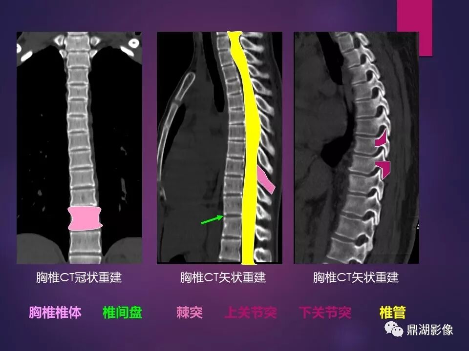 全身骨肌系统正常影像解剖（高清图谱）