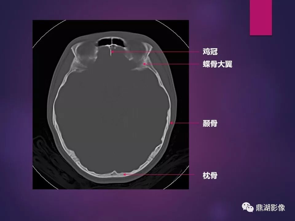 全身骨肌系统正常影像解剖（高清图谱）