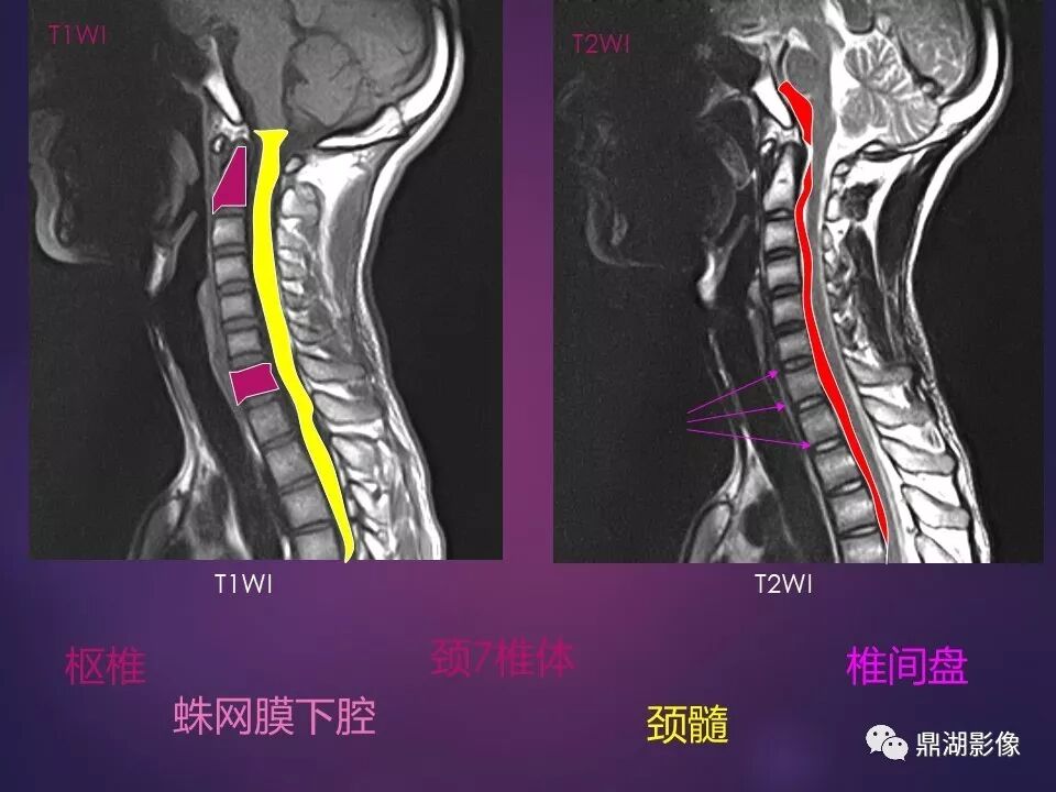 全身骨肌系统正常影像解剖（高清图谱）