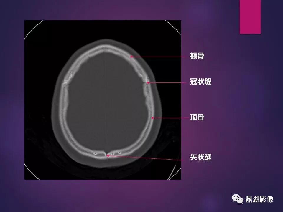 全身骨肌系统正常影像解剖（高清图谱）
