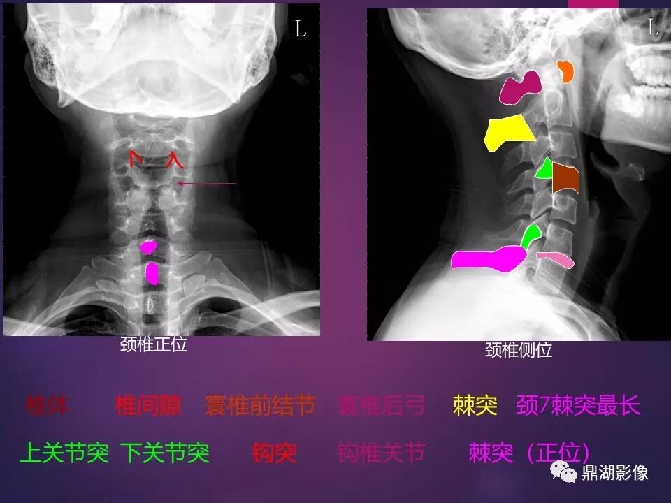 全身骨肌系统正常影像解剖（高清图谱）