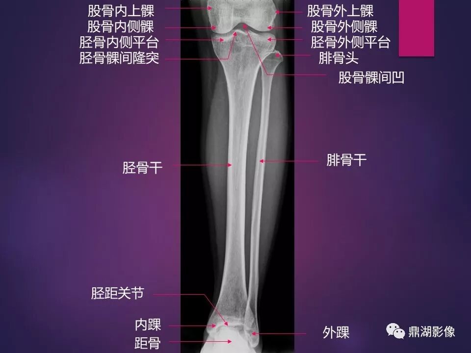 全身骨肌系统正常影像解剖（高清图谱）